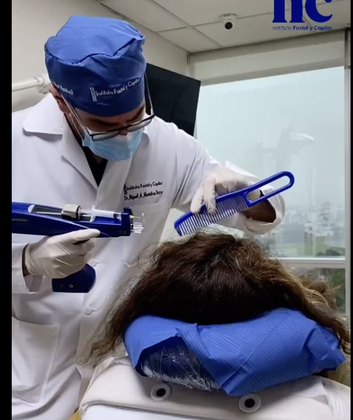 Mesoterapia capilar IFC